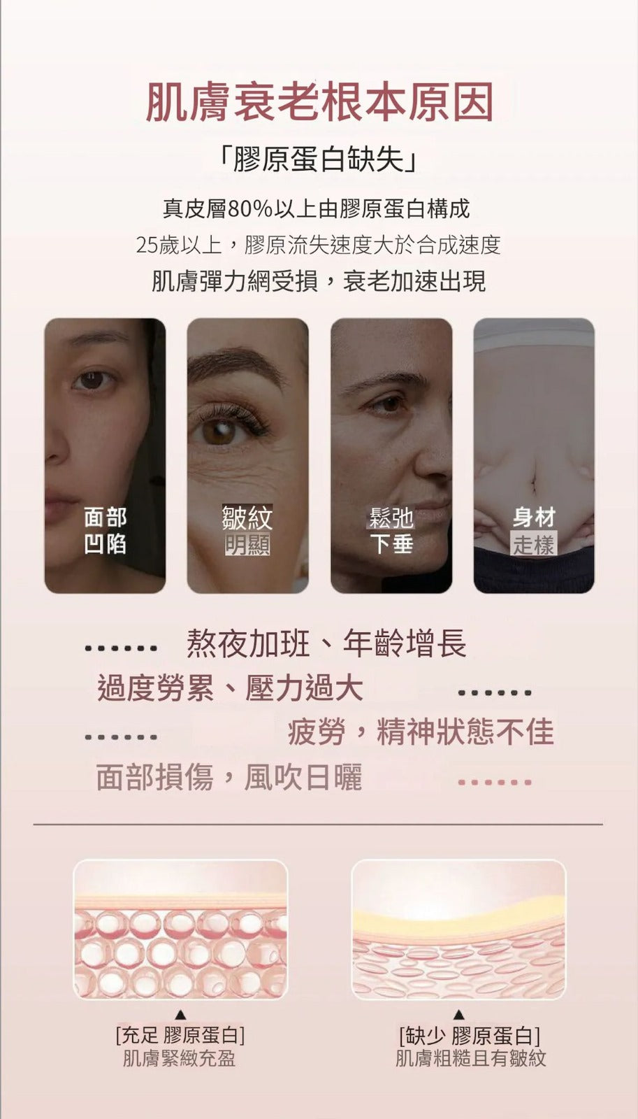 Pre-order 韓國熱賣🔥ILO - Type 1 膠原蛋白安瓶 - 28日份 => 12月下旬到貨